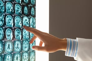 Close-up image of doctors hand pointing at x-ray results-2