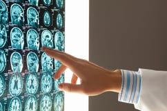 Close-up image of doctors hand pointing at x-ray results-3