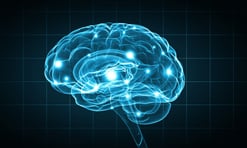 epilepsy brain abnormalities